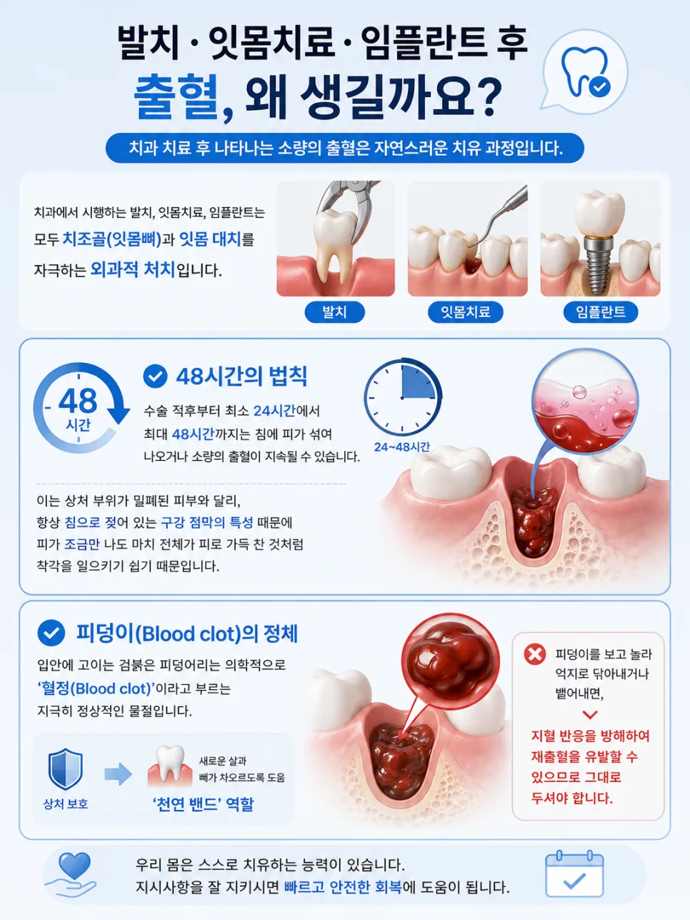 연수구 발치·임플란트 후 출혈, 거즈 압박 지혈과 48시간 관리 관련 사진 2