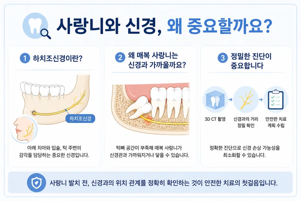 송도 매복 사랑니 발치와 하치조신경, 신경 손상 위험 바로 알기 관련 사진 2