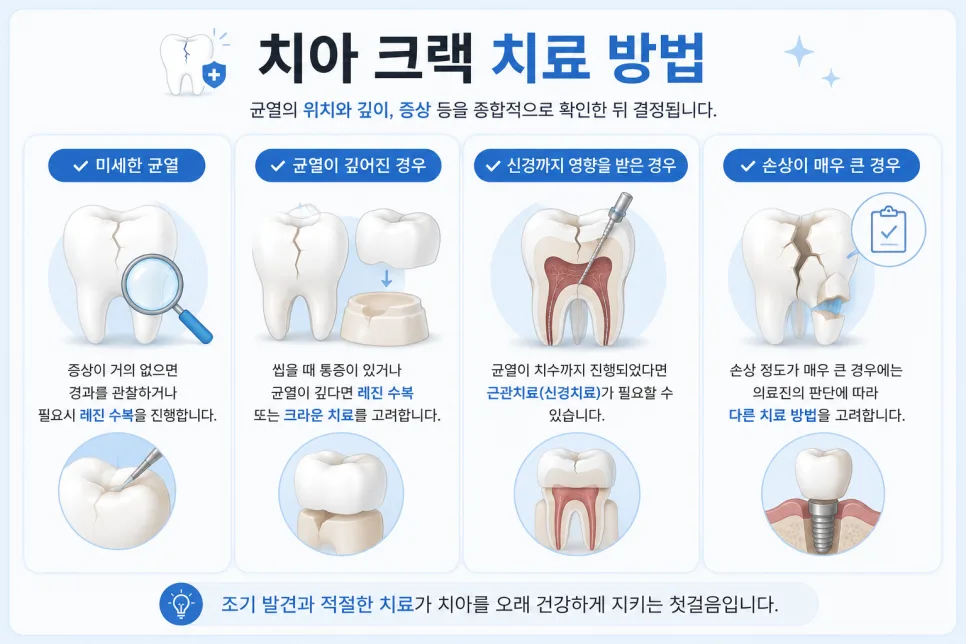 송도치과 치아 크랙, 금 간 치아를 방치하면 생기는 변화 관련 사진 3