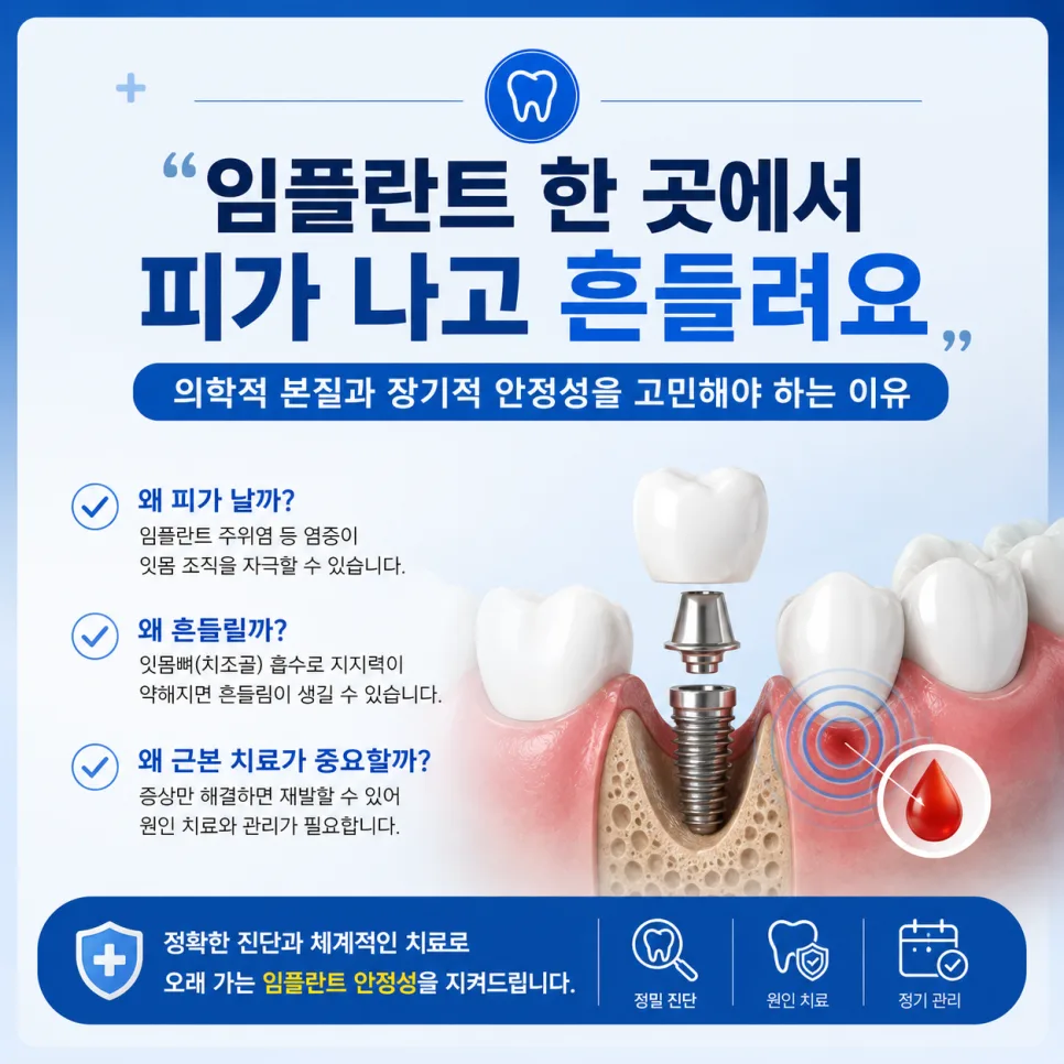 송도 임플란트, 피가 나고 흔들리는 이유와 장기 안정성 관련 사진 1