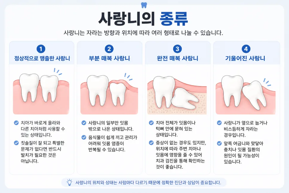 송도 사랑니 발치, 꼭 뽑아야 하는 경우와 진행 과정 관련 사진 2