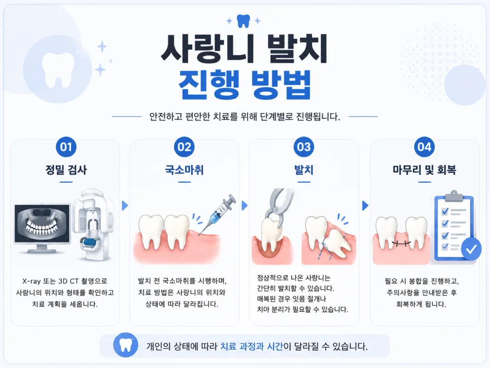 송도 사랑니 발치, 꼭 뽑아야 하는 경우와 진행 과정 관련 사진 3