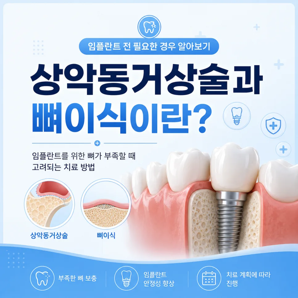 송도치과 상악동거상술과 뼈이식, 임플란트 전 필요한 경우 안내 관련 사진 1
