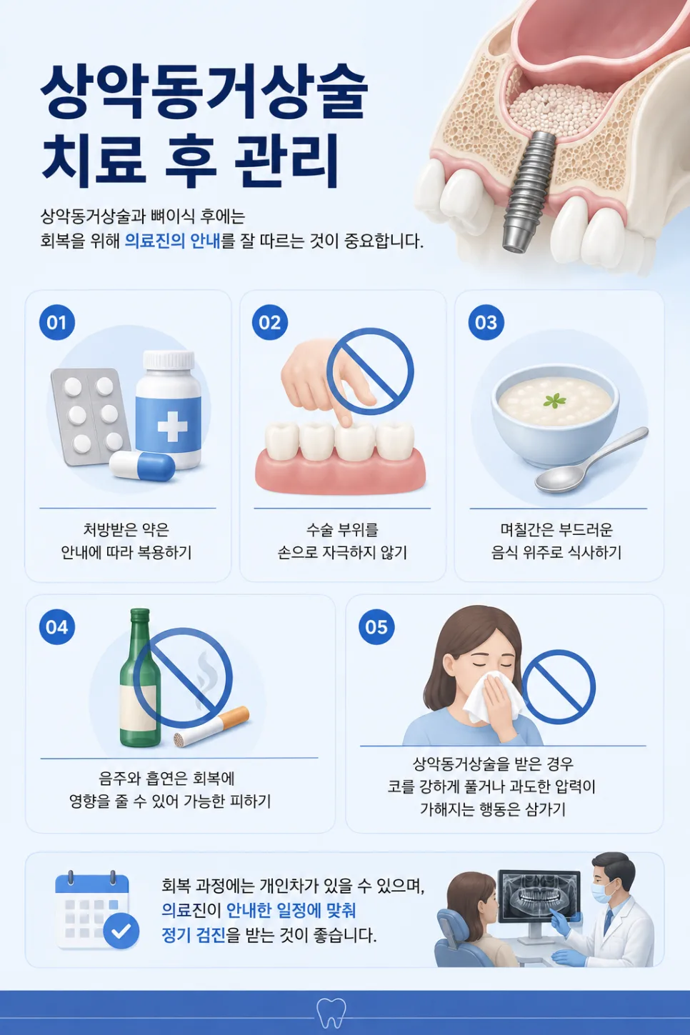 송도치과 상악동거상술과 뼈이식, 임플란트 전 필요한 경우 안내 관련 사진 4
