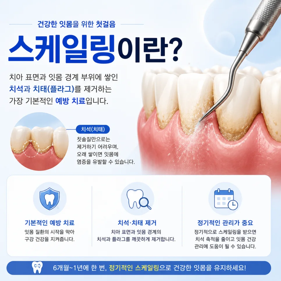 송도 잇몸치료, 스케일링과 치주치료·치주수술의 차이 관련 사진 2