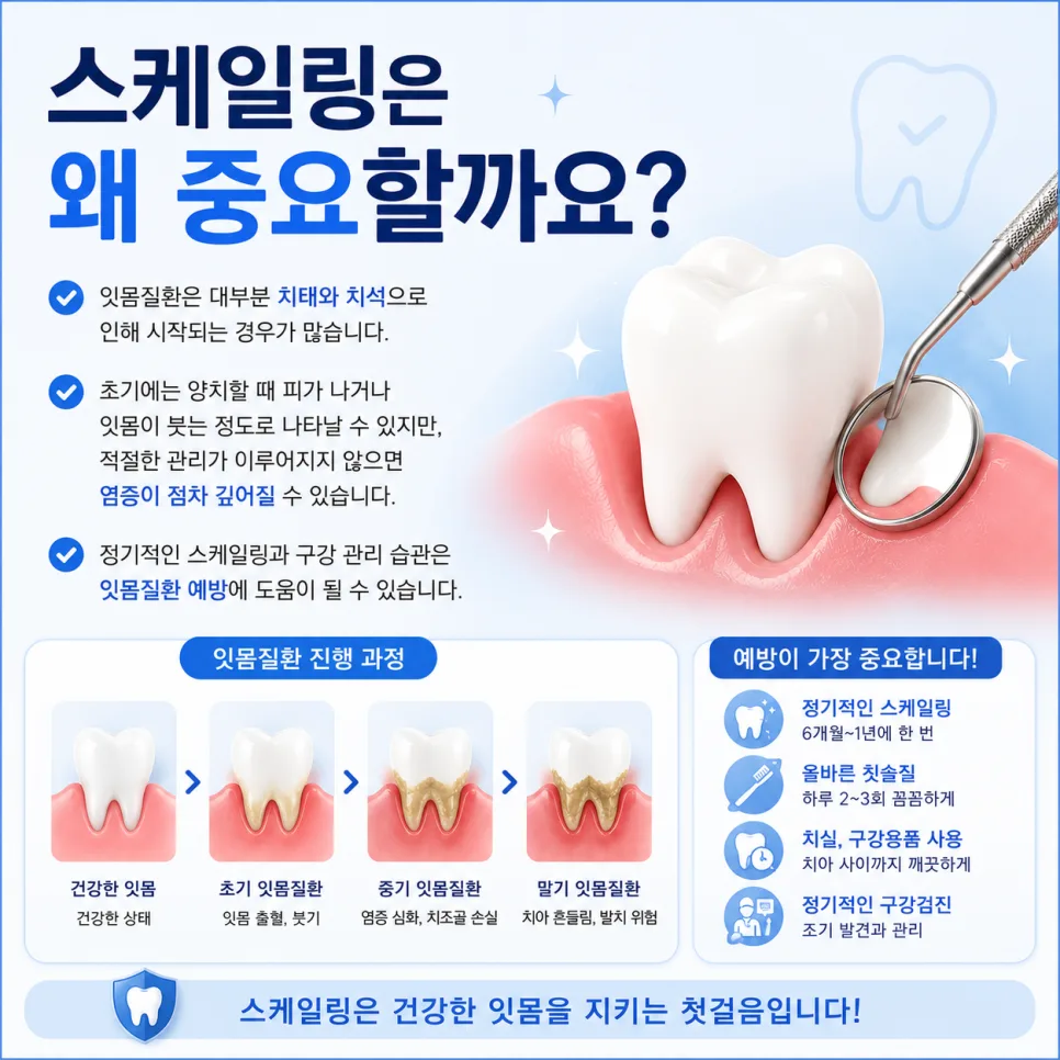 송도 잇몸치료, 스케일링과 치주치료·치주수술의 차이 관련 사진 3