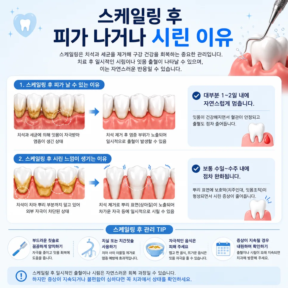 송도 잇몸치료, 스케일링과 치주치료·치주수술의 차이 관련 사진 4