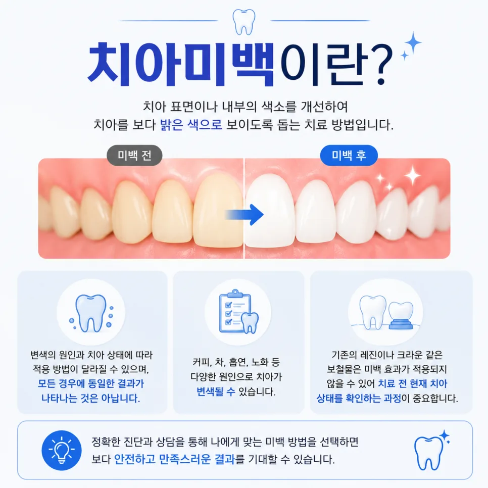 송도 치아미백, 오피스·홈·듀얼 방법을 고르는 기준 관련 사진 2