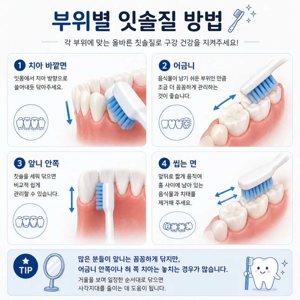 인천 송도 치과가 안내하는 올바른 잇솔질 방법과 주의할 습관 관련 사진 3