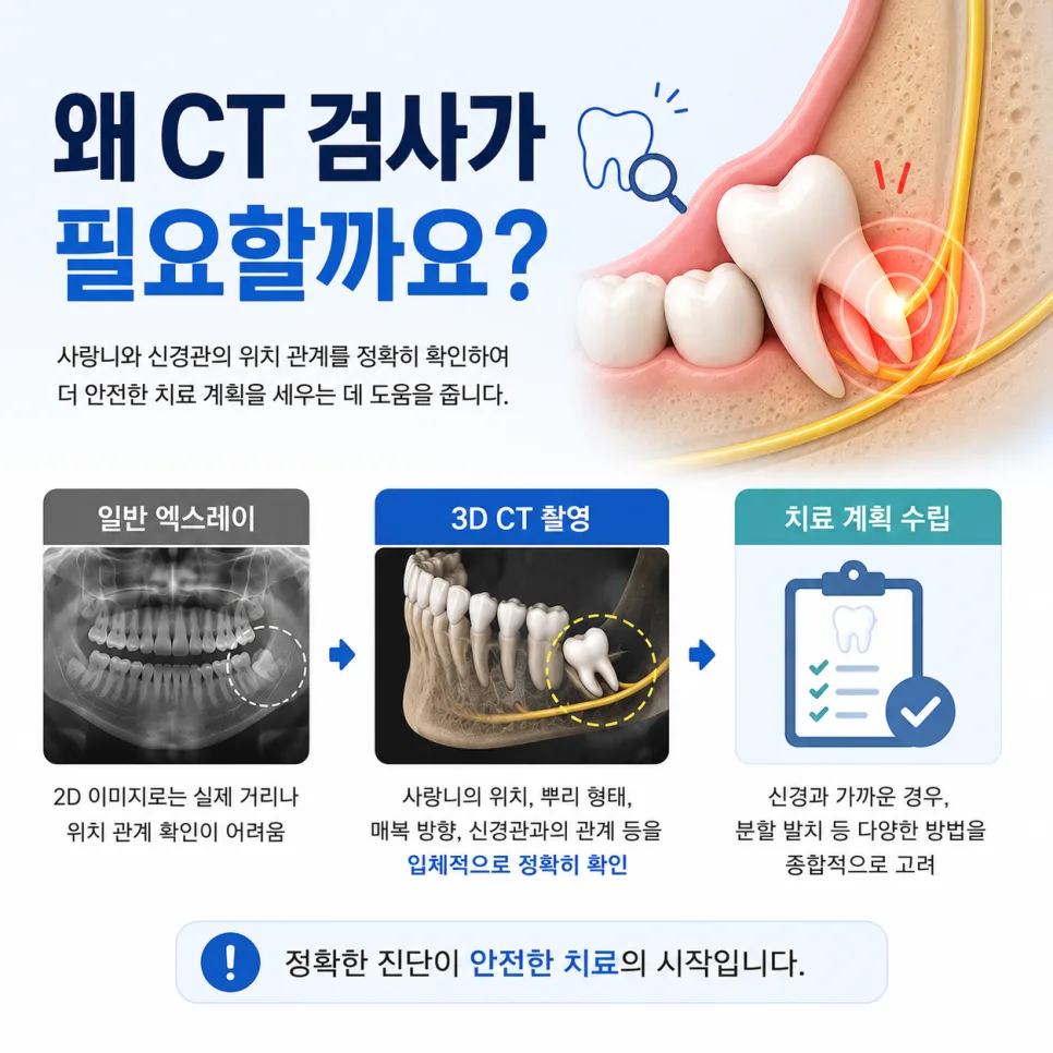 국제업무지구역 사랑니, 하치조신경과 가까울 때 확인하는 것 관련 사진 2
