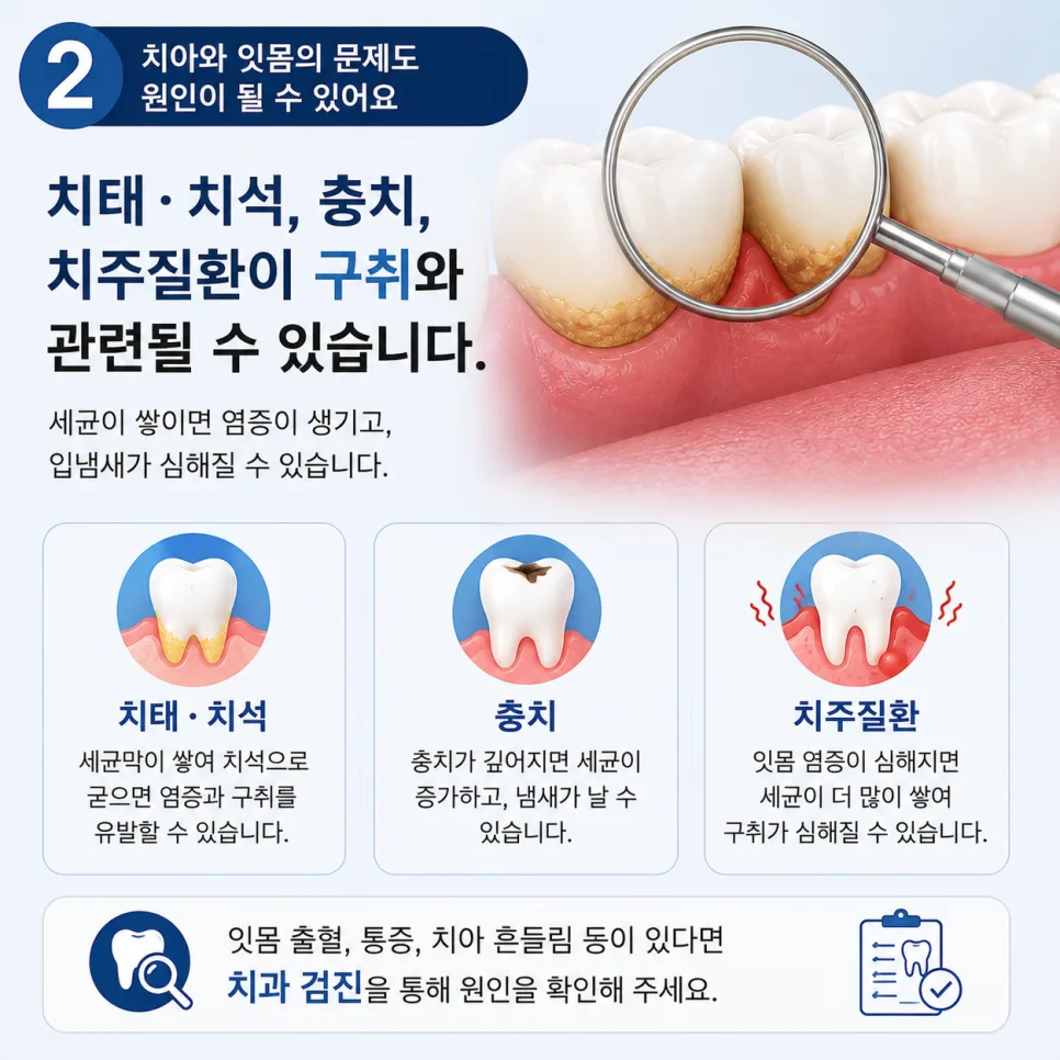 구월동치과 구취, 입냄새가 지속되는 원인과 관리 순서 관련 사진 3