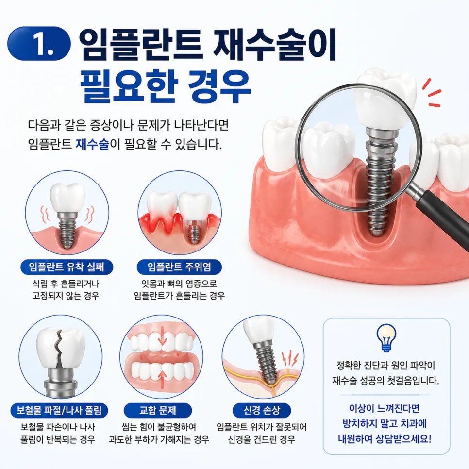 인천 송도 치과 임플란트 재수술, 원인 확인과 치료 과정 안내 관련 사진 2