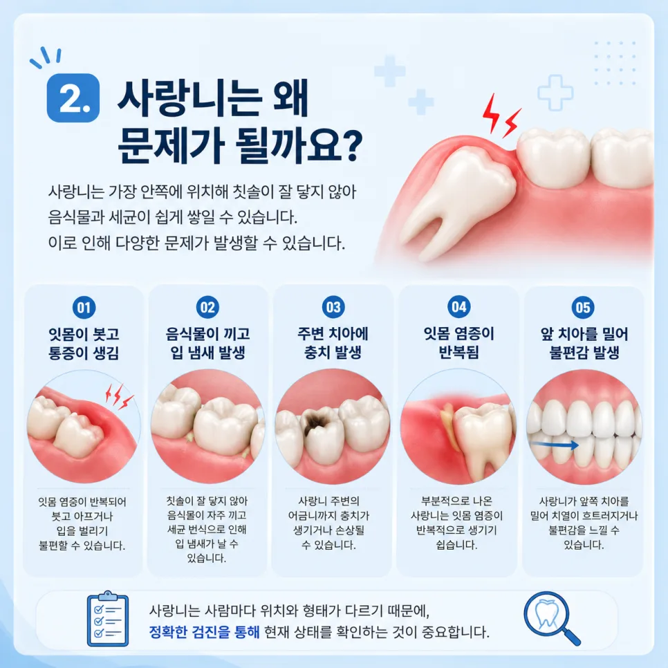 송도동 치과 사랑니, 발치를 고려하는 경우와 발치 후 관리 관련 사진 3