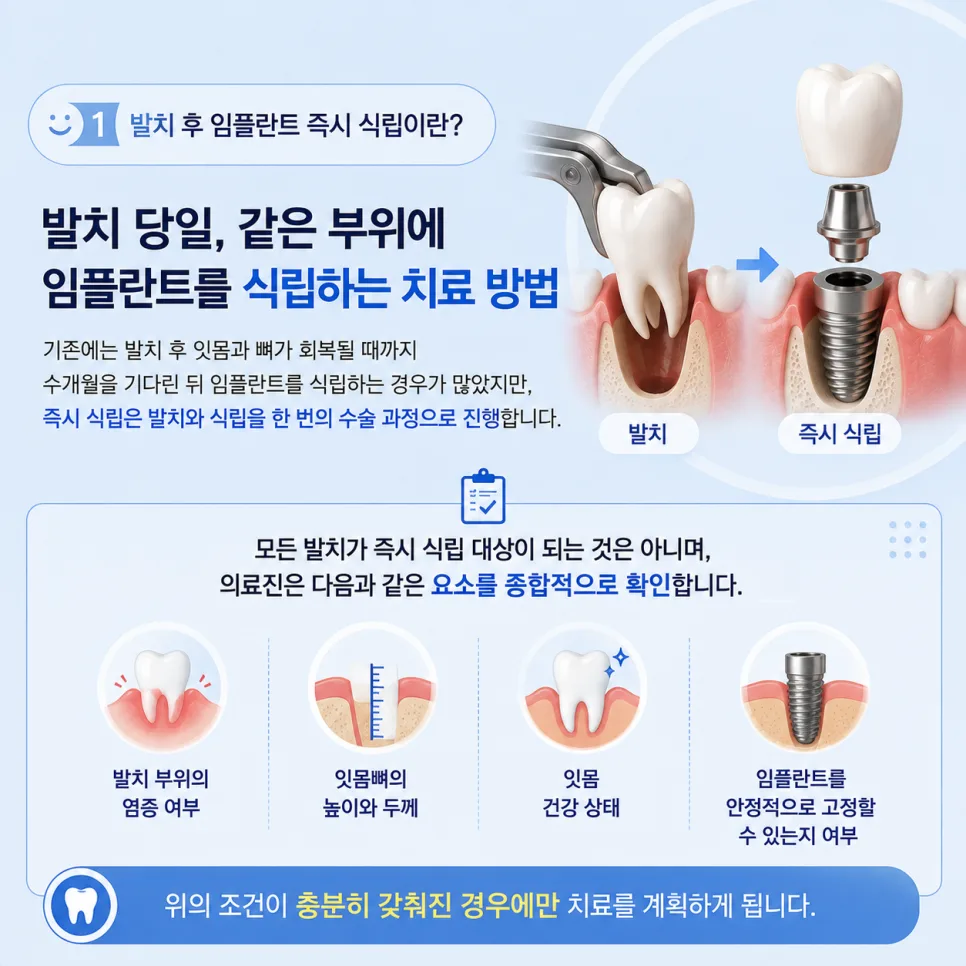 동춘동 치과 발치 후 임플란트 즉시 식립이 가능한 조건과 치료 과정 관련 사진 2