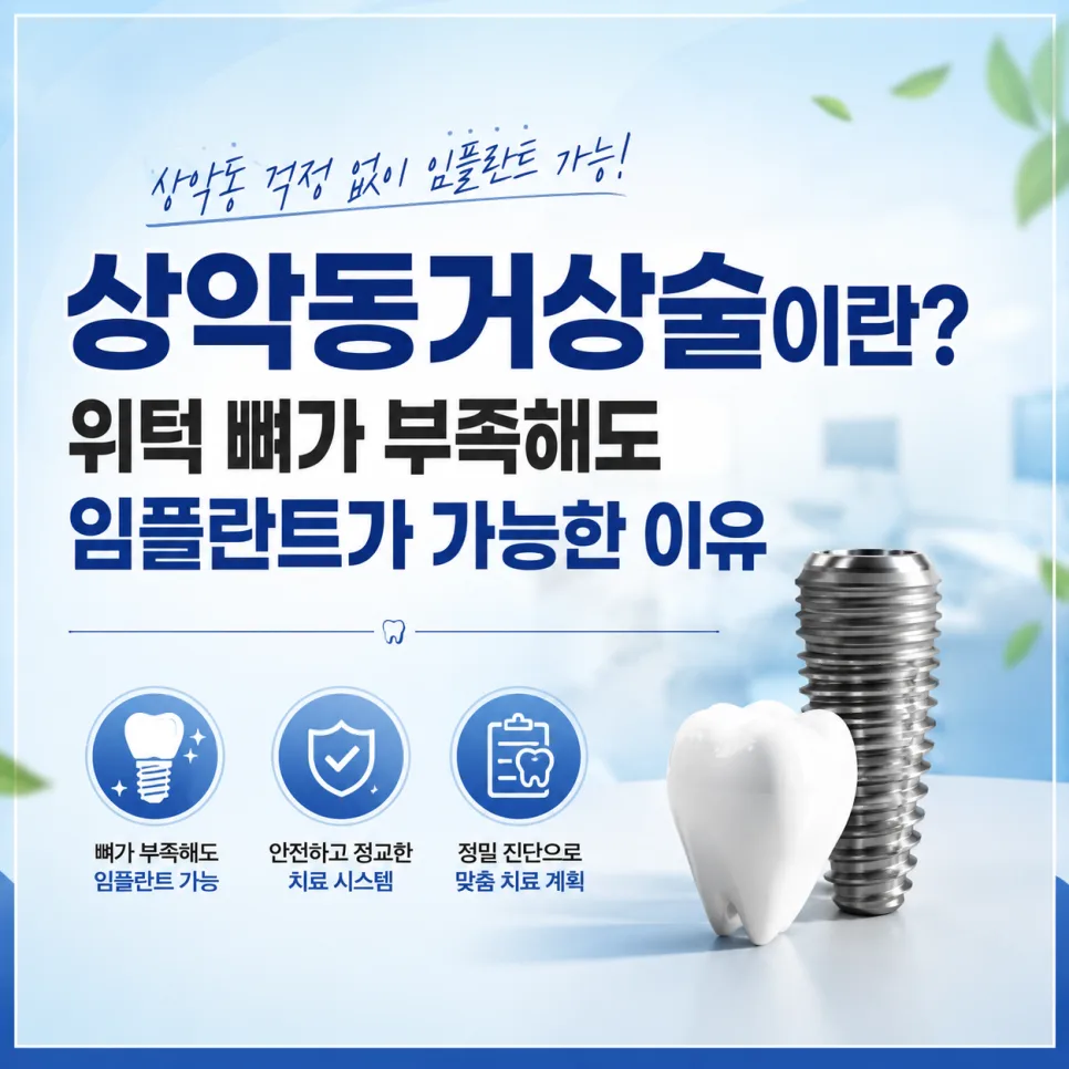송도 상악동거상술, 위턱 잇몸뼈가 부족해도 임플란트가 가능한 이유 관련 사진 1