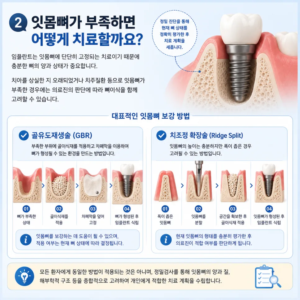 송도 고난이도 임플란트, 잇몸뼈가 부족하거나 지병이 있을 때의 치료 계획 관련 사진 3
