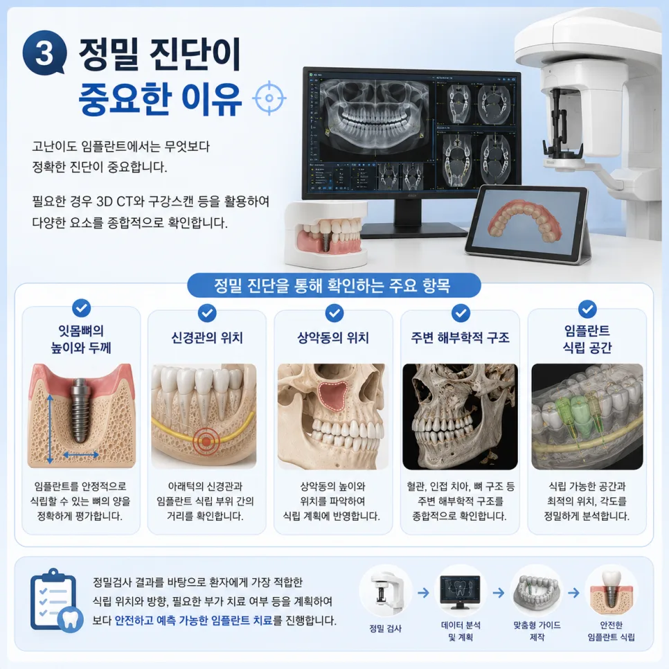 송도 고난이도 임플란트, 잇몸뼈가 부족하거나 지병이 있을 때의 치료 계획 관련 사진 4