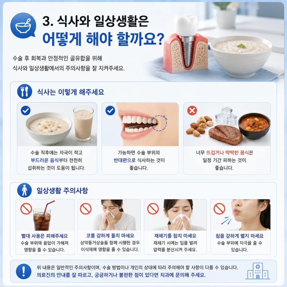 송도동 임플란트 주의사항, 수술 전 준비부터 장기 관리까지 관련 사진 4