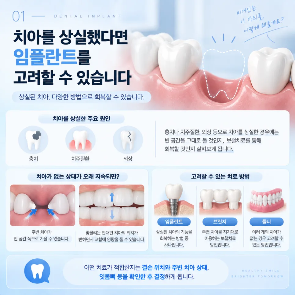 송도 임플란트, 이가 빠졌을 때 치료 방법을 정하는 기준 관련 사진 2