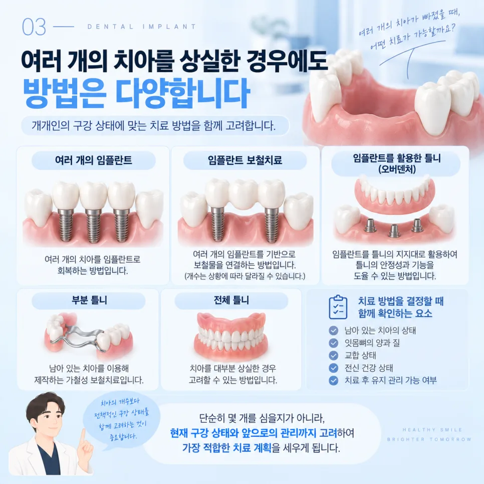 송도 임플란트, 이가 빠졌을 때 치료 방법을 정하는 기준 관련 사진 4